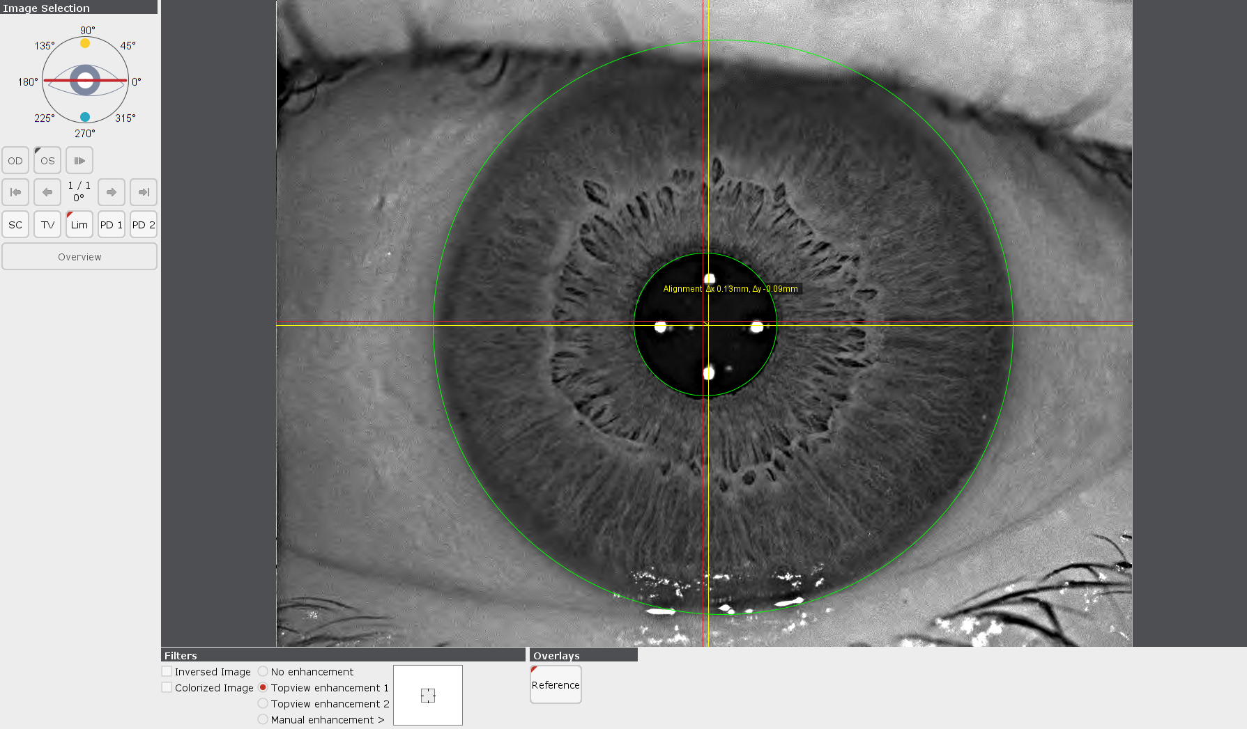The TopView image in vibrant colors and with high contrast improves the visualization of details such as blood vessels, iris pattern and pupil.