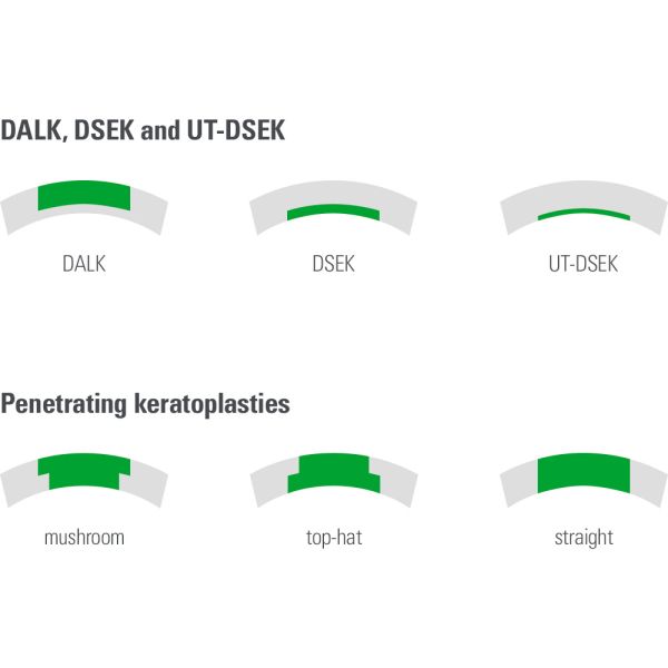 Choose between different ultra-thin lamellar Keratoplasties (DALK, DSEK, UT-DSEK) and penetrating Keratoplasties (mushroom, top-hat, straight).
