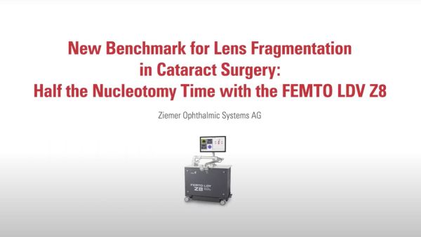 The updated Cataract software on FEMTO LDV Z8 sets a new benchmark for lens fragmentation in Cataract surgery. This video shows that by using this software on FEMTO LDV Z8, the time of the nucleotomy part can be reduced by half. 