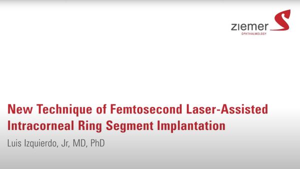 Luis Izquierdo, Jr, MD, PhD explains the benefits of the new technique of femtosecond laser-assisted ring segment (ICRS) implantation that was first performed with the Ziemer FEMTO LDV Z models.
