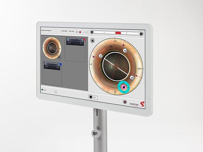 Enhanced eye structure detection (iris, lens, cornea) yields a faster OCT scan and in general a quicker processing time.