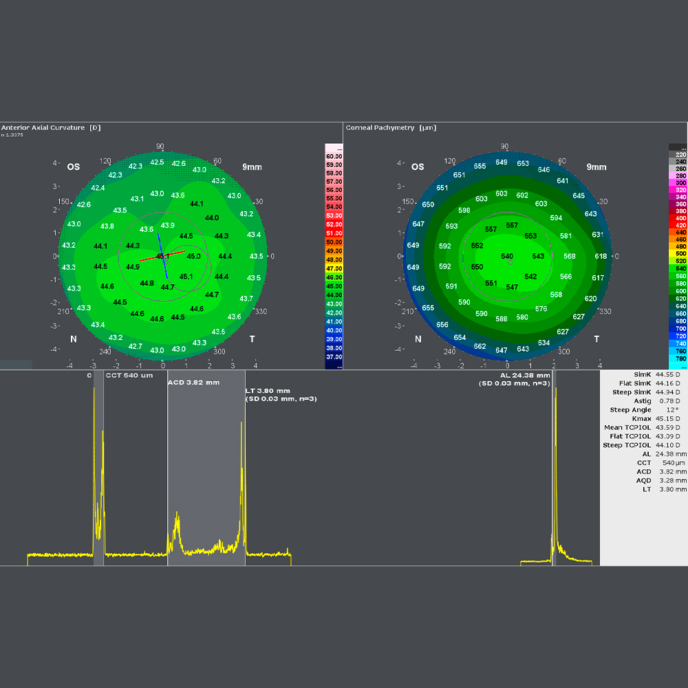 GALILEI G6 ColorZ / Ziemer Ophthalmic Systems AG