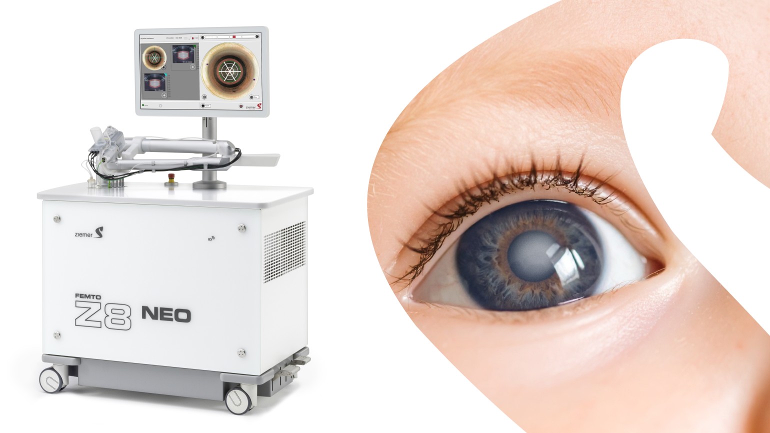 Z8 Platforms - The Benchmark in Pediatric Cataract Surgery Technology